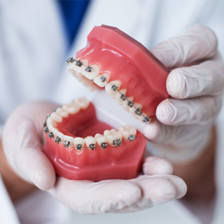 Ortodonti - Diş Teli 